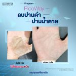ปานดำ