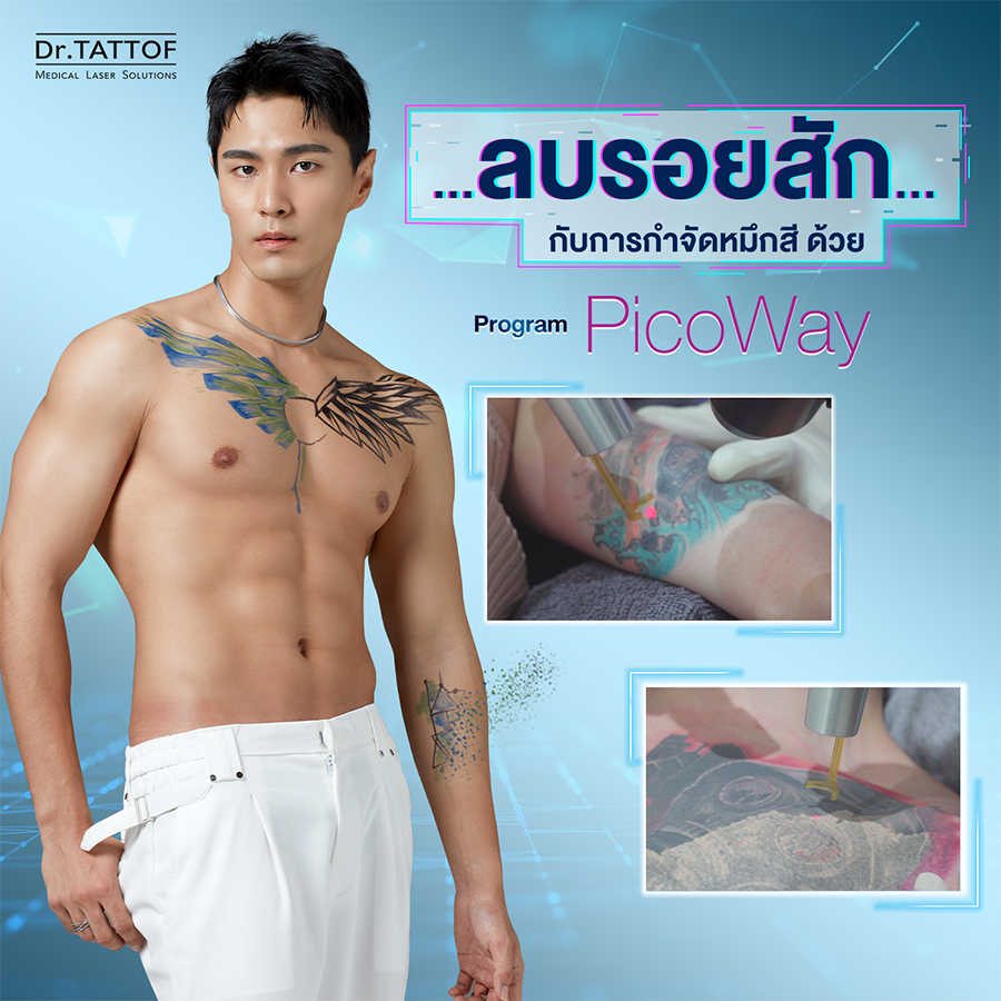 PicoWay Laser ลบรอยสัก