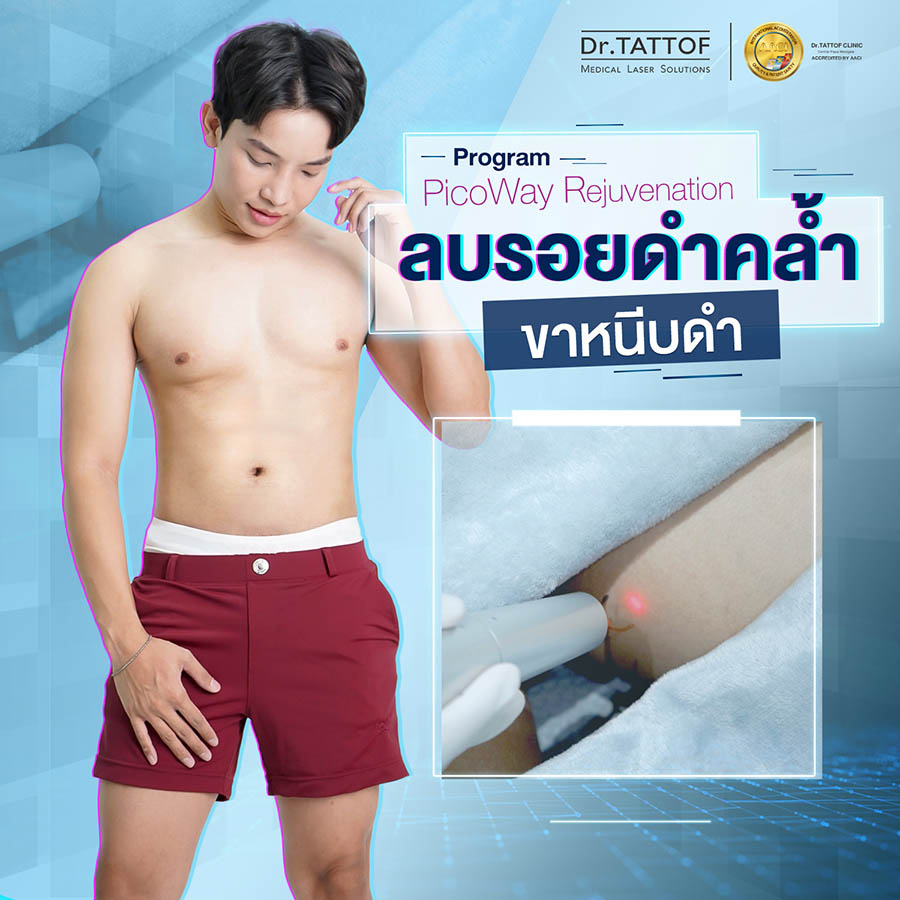 เลเซอร์ขาหนีบดำ